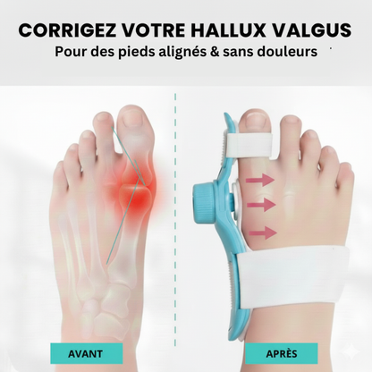 Hallux-Valgus-Korrektor Pro